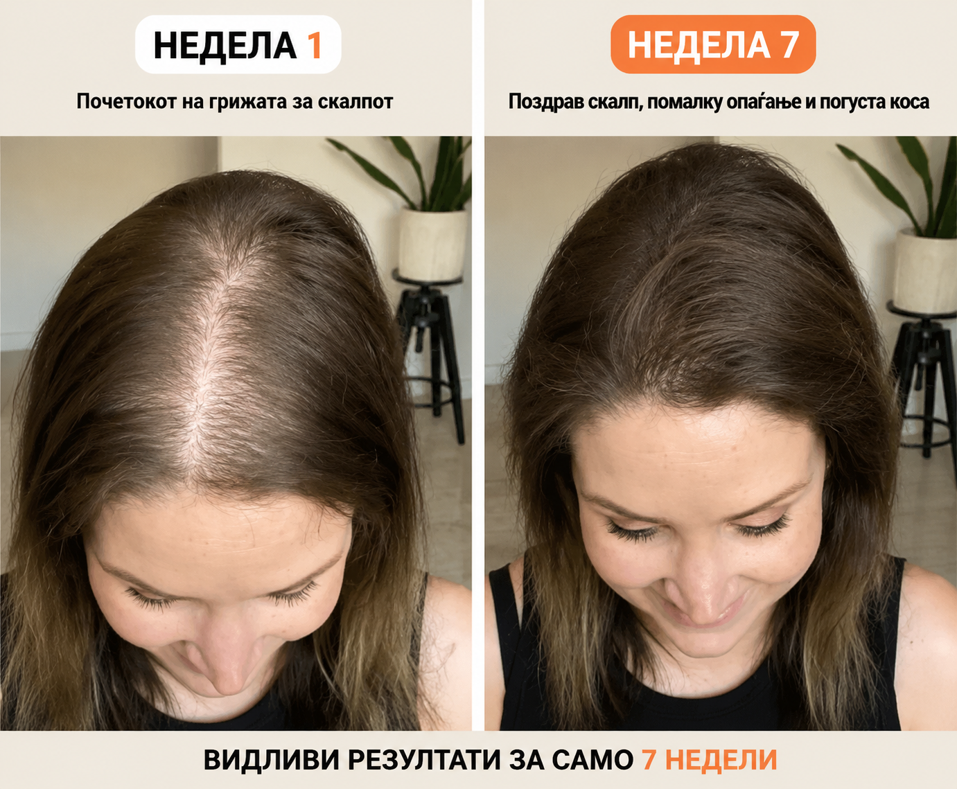 Корејски #1 Серум за раст на коса