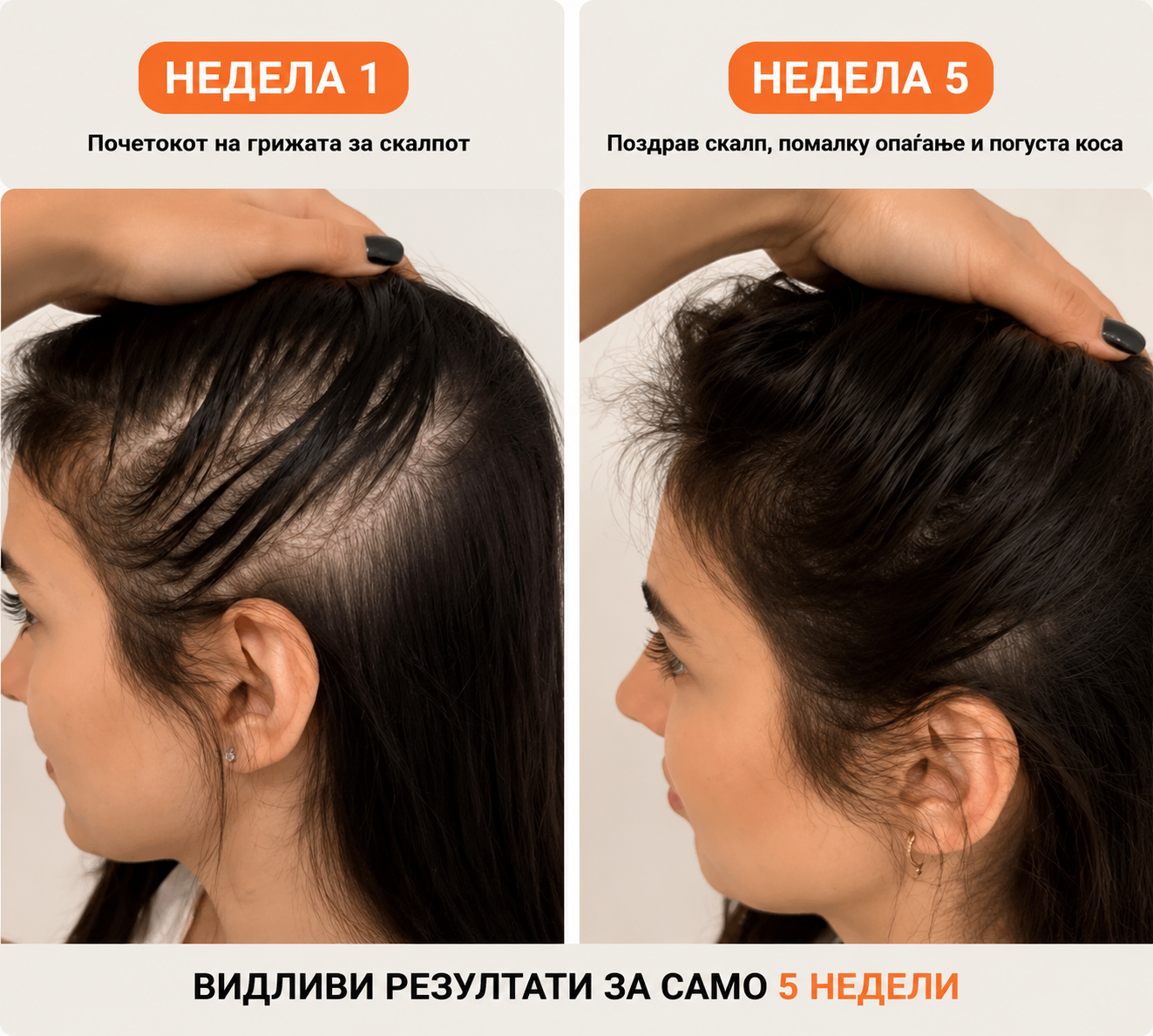 Корејски #1 Серум за раст на коса
