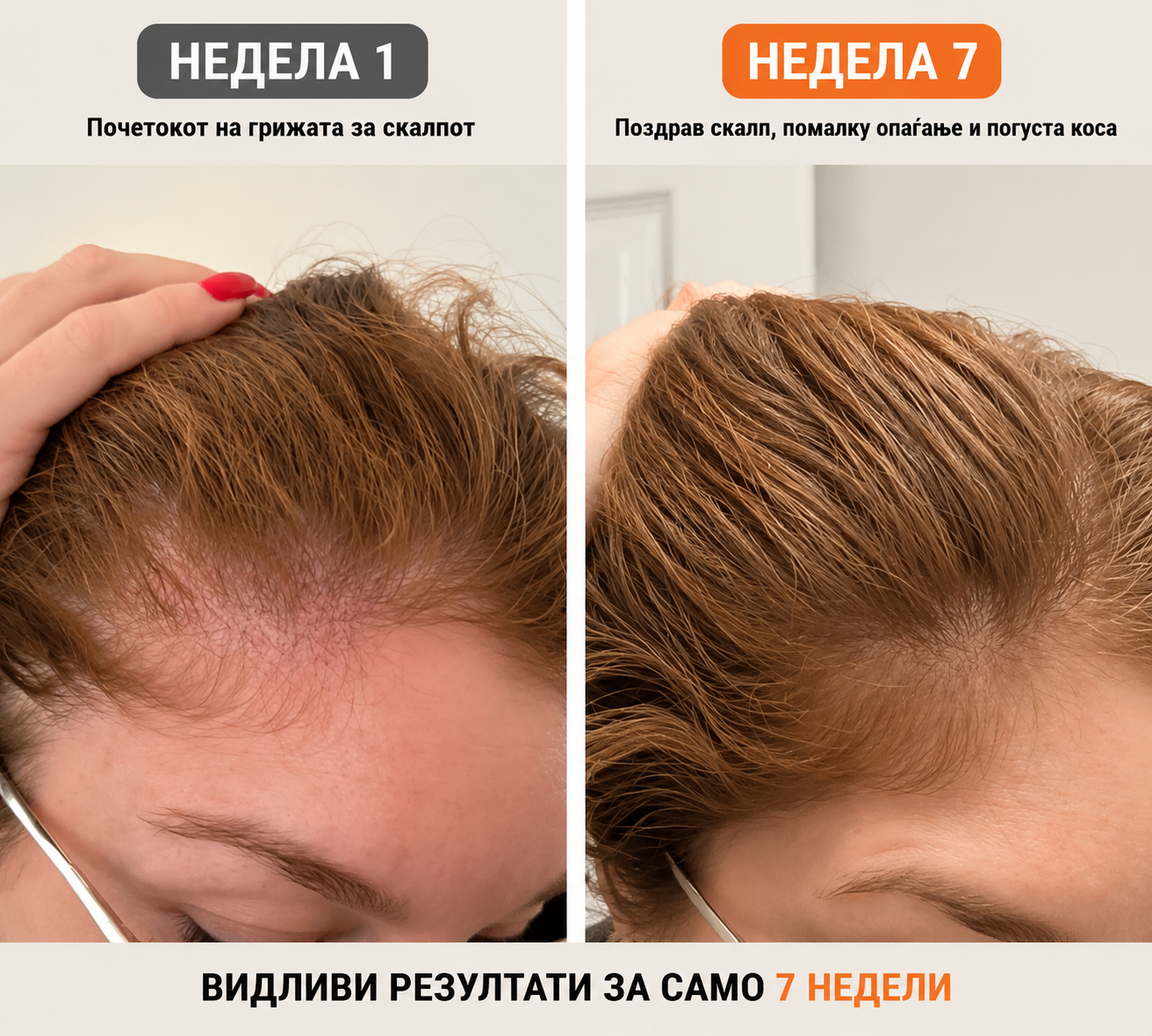 Корејски #1 Серум за раст на коса