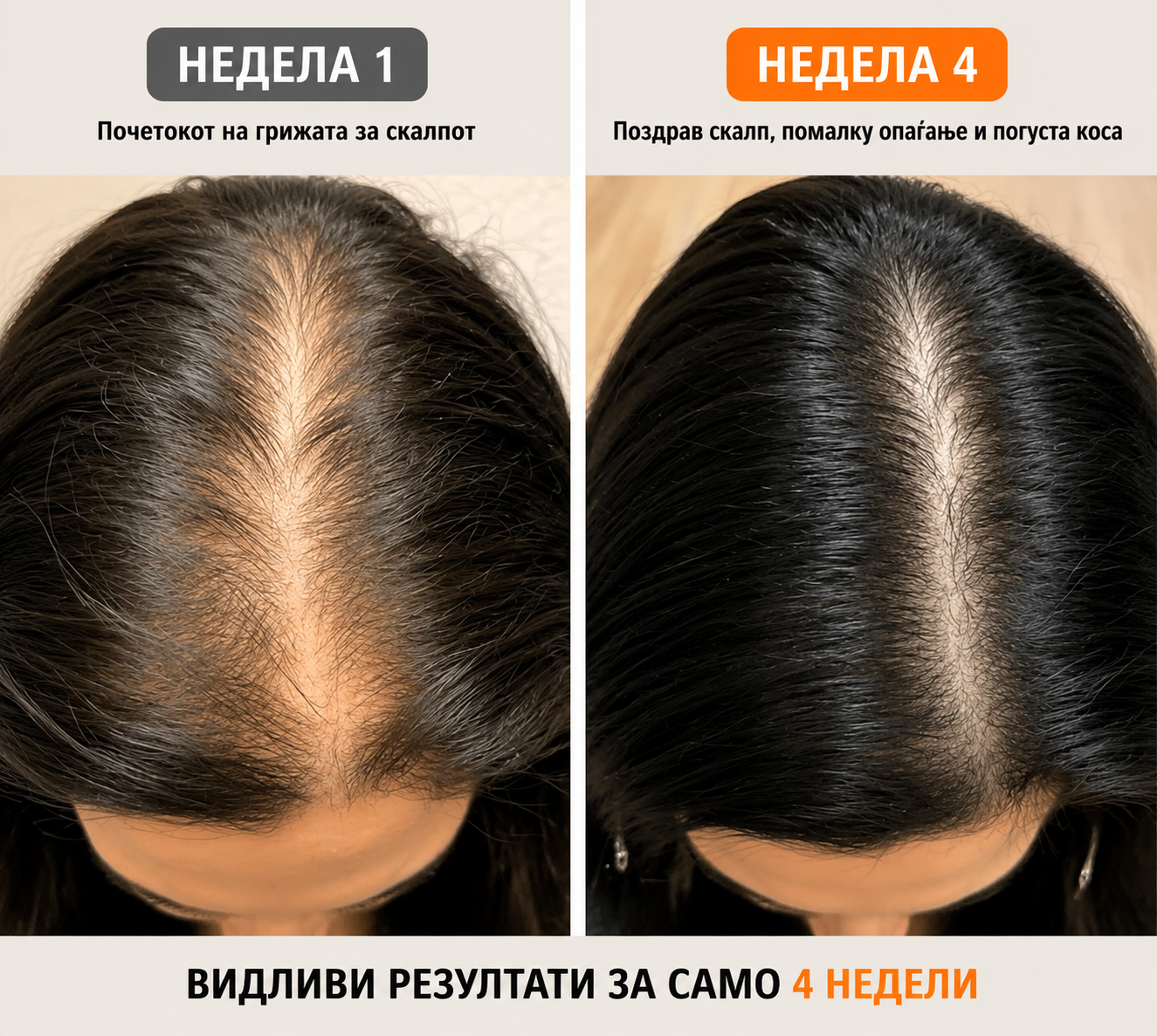 Корејски #1 Серум за раст на коса