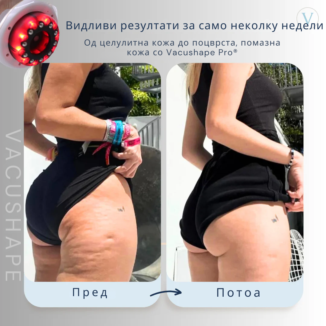 VacuShape Pro -Поцврста,Позатегната кожа